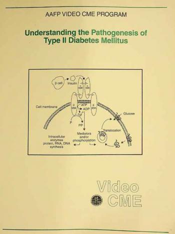 Understanding pathogenesis of type II diabetes mellitus