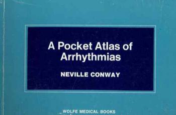  A pocket atlas of arrhythmias for nurses