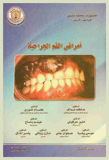  أمراض الفم الجراحية