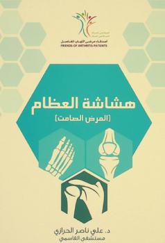  هشاشة العظام : المرض الصامت