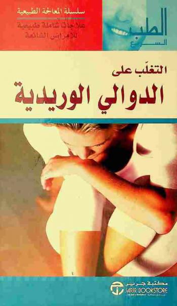  التغلب على الدوالي الوريدية