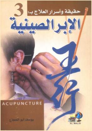  حقيقة وأسرار العلاج بالإبر الصينية