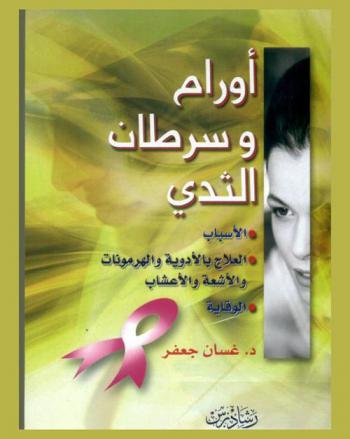 أورام وسرطان الثدي : الأسباب-العلاج بالأدوية والهرمونات والأشعة والأعشاب-الوقاية