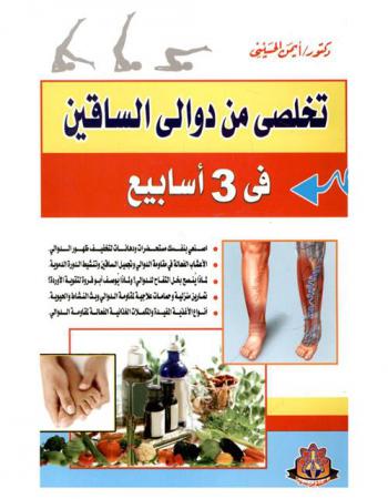  تخلصي من دوالي الساقين في 3 أسابيع