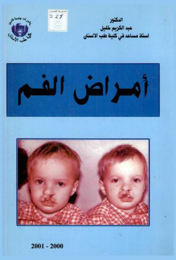  أمراض الفم = Oral diseases