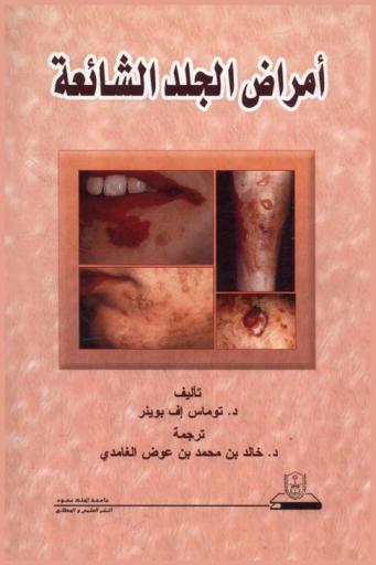 أمراض الجلد الشائعة