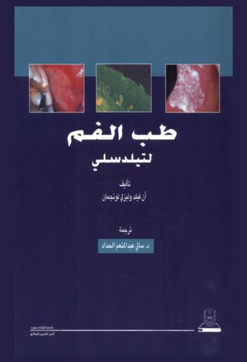  طب الفم لتيلدسلي