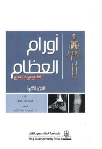  أورام العظام : التشخيص والعلاج