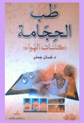 طب الحجامة : كاسات الهواء