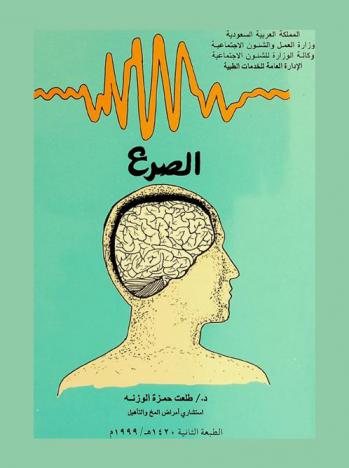  الصرع