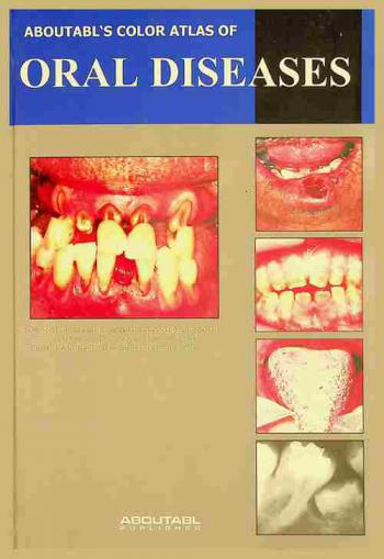  AbouTabl color atlas of oral diseases