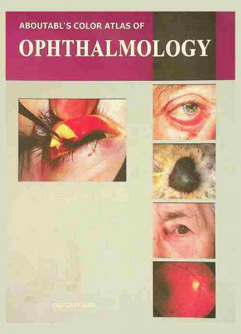  Abou Tabl color atlas of ophthalmology