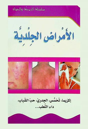  أمراض الجلد : إكزيما، تحسس، الجدري، حب الشباب، داء الثعلب ...