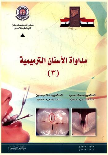  مداواة الأسنان الترميمية