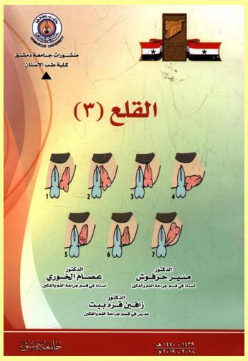  القلع = Exodontia