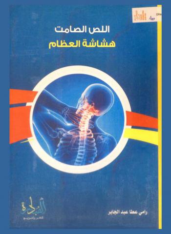  اللص الصامت : هشاشة العظام : الأسباب-الوقاية-العلاج