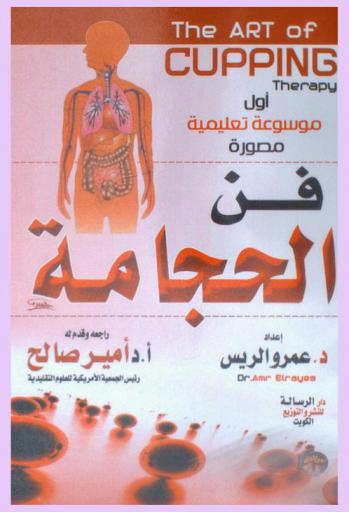  فن الحجامة = The art of cupping therapy