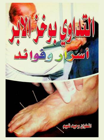  التداوي بوخز الإبر : أسرار وفوائد