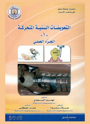  التعويضات السنية المتحركة (1) : الجزء العملي