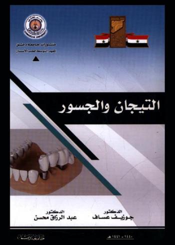  التيجان والجسور