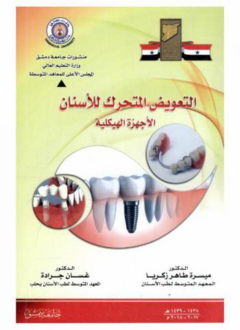  التعويض المتحرك للأسنان : الأجهزة الهيكلية