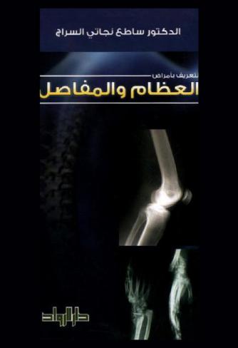  التعريف بأمراض العظام والمفاصل
