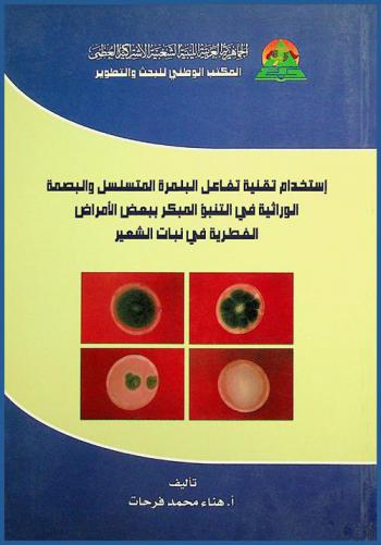 استخدام تقنية تفاعل البلمرة المتسلسل والبصمة الوراثية في التنبؤ المبكر ببعض الأمراض الفطرية في نبات الشعير
