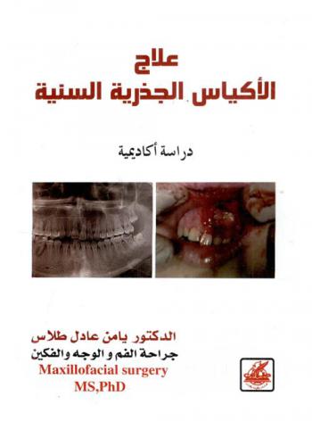  علاج الأكياس الجذرية السنية : دراسة أكاديمية