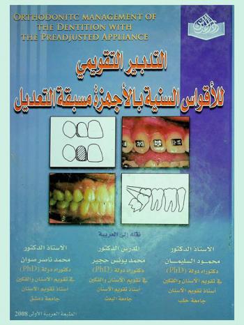  التدبير التقويمي للأقواس السنية بالأجهزة مسبقة التعديل