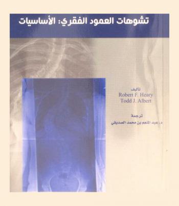  تشوهات العمود الفقرى : الأساسيات