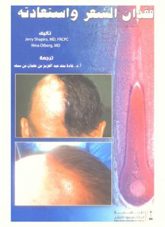  فقدان الشعر واستعادته