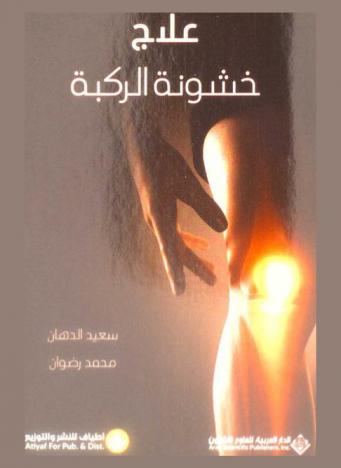  علاج خشونة الركبة